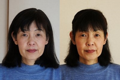 \Wbgwi[NVbvQ҂̃PAO